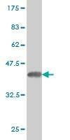Anti-CYP2J2 Antibody