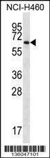 Anti-ZBTB46 (Center) Antibody