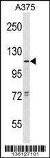 Anti-TAS1R1 (Center) Antibody