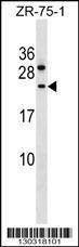 Anti-CCDC140 (N-term) Antibody