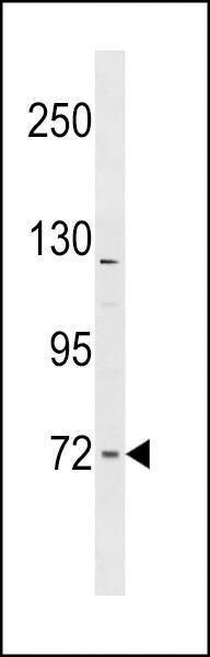 Anti-FNBP1L (Center) Antibody