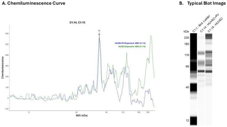 Cell Lysate: HUVEC + PV | Secondary Ab: Rabbit | Exposure: HDR | Expected MW (kDa): 133