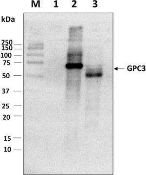 Anti-Glypican-3 (511~560aa) Antibody