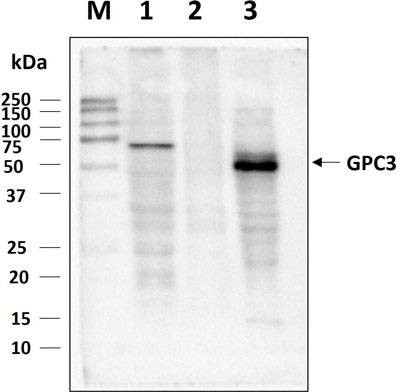 Anti-Glypican-3 (511~560aa) Antibody