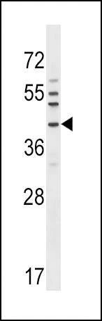 Anti-NKX6-1 (C-term) Antibody