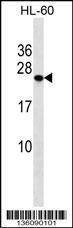 Anti-PCTP (Center) Antibody