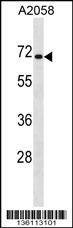 Anti-CPEB1 (C-term) Antibody