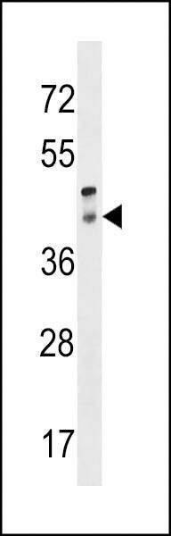 Anti-RRH (C-term) Antibody