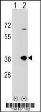 Anti-SULT1B1 (C-term) Antibody