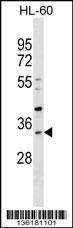 Anti-SULT1B1 (C-term) Antibody