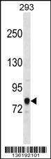 Anti-ACSL3 (C-term) Antibody