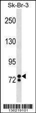 Anti-ZNF263 (Center) Antibody