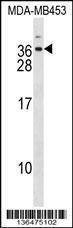 Anti-DLX6 (Center) Antibody