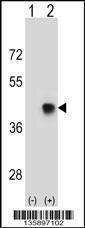 Anti-SPEM1 (Center) Antibody