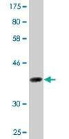 Anti-DAZAP1 Antibody