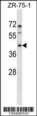 Anti-PANX3 (N-term) Antibody