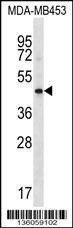 Anti-HAPLN3 (Center) Antibody