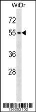 Anti-NUP50 (Center) Antibody