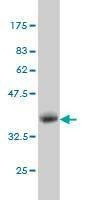 Anti-DCAKD Antibody