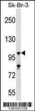 Anti-USP16 (N-term) Antibody