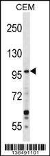 Anti-GREB1 (Center) Antibody