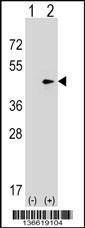 Anti-SEPT2 (C-term) Antibody