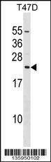 Anti-EIF3K (C-term) Antibody