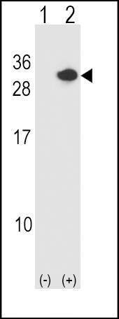 Anti-RCAN1 (N-term) Antibody
