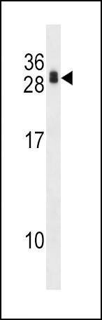 Anti-RCAN1 (N-term) Antibody