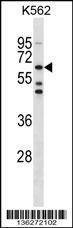Anti-TESK1 (Center) Antibody