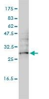 Anti-DC-UbP Antibody