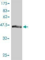 Anti-DC-UbP Antibody