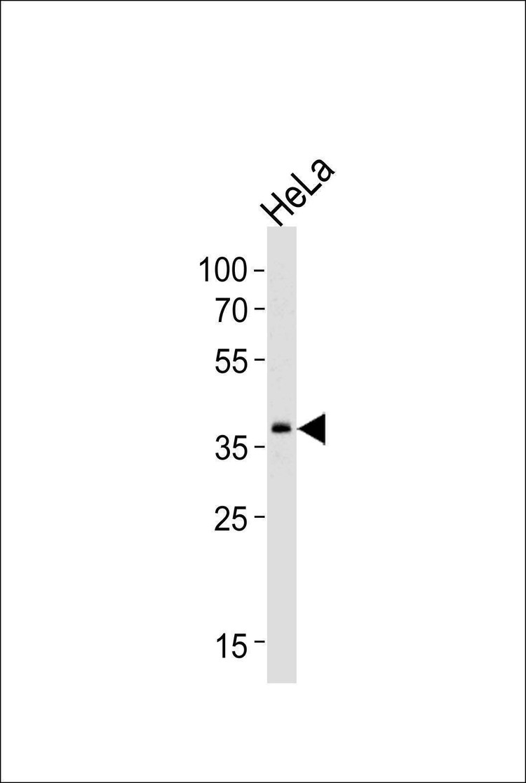 Anti-SRPX (Center) Antibody
