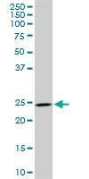 Anti-DCUN1D1 Antibody