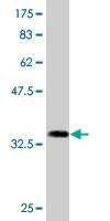 Anti-DCUN1D1 Antibody