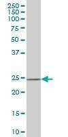 Anti-DCUN1D1 Antibody