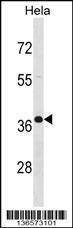 Anti-PABPN1 (C-term) Antibody