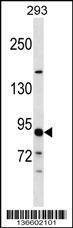 Anti-TUBGCP3 (C-term) Antibody