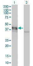 Anti-DCX Antibody