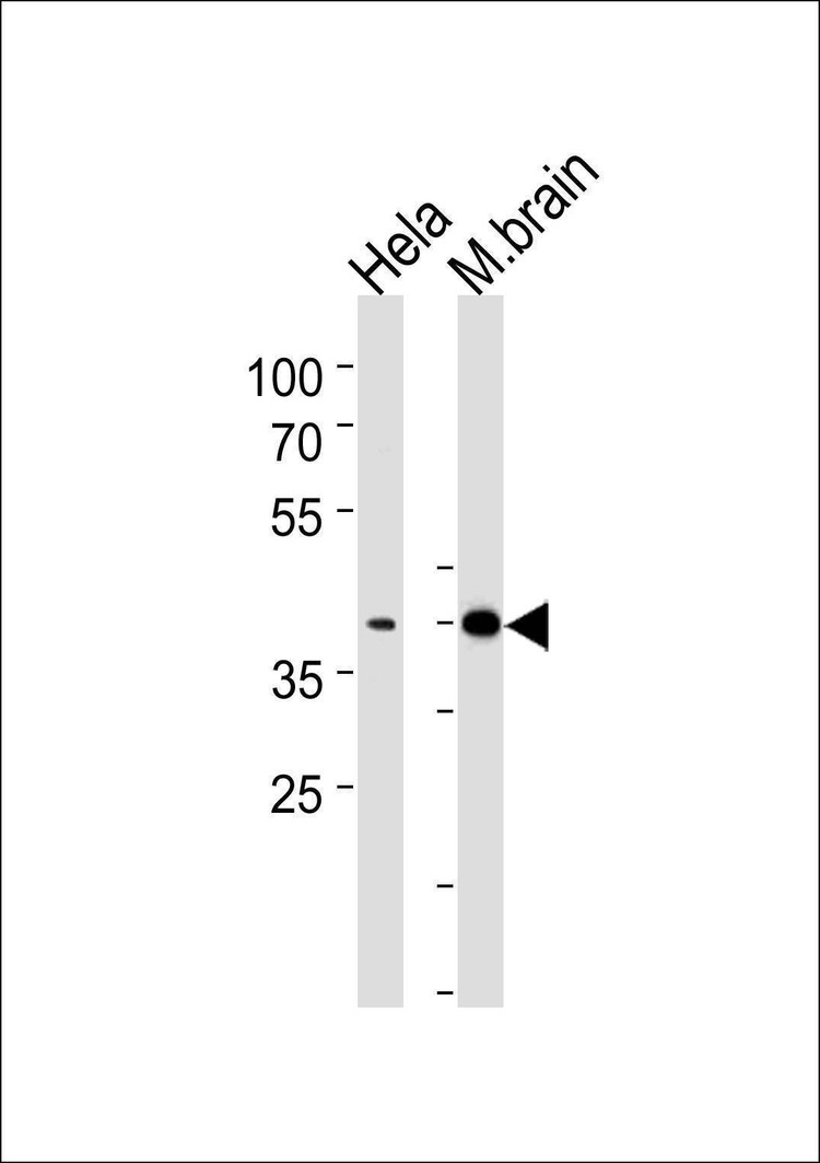 Anti-ATF2 (Center T339) Antibody