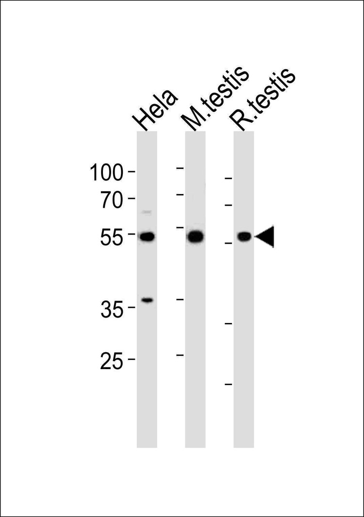 Anti-HDAC1 (Center S423) Antibody