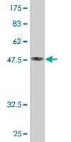 Anti-DDAH2 Antibody