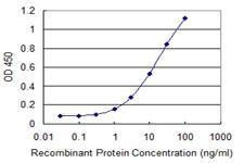 Anti-DDAH2 Antibody