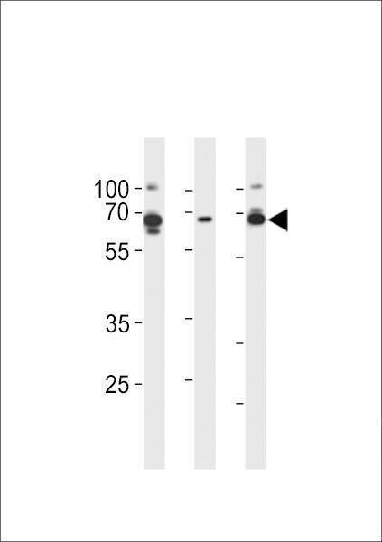 Anti-PRKAG3 (C-term) Antibody