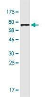 Anti-DDC Antibody