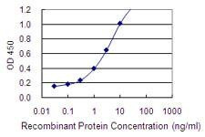 Anti-DDC Antibody