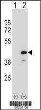 Anti-PTPN18 (C-term) Antibody