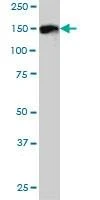Anti-DDEF1 Antibody