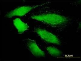 Anti-DDEF1 Antibody