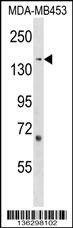 Anti-ARHGEF11 (Center) Antibody